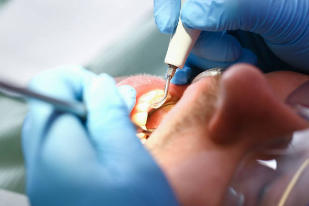 Best Emergency Treatment for Toothache in Midlothian, IL